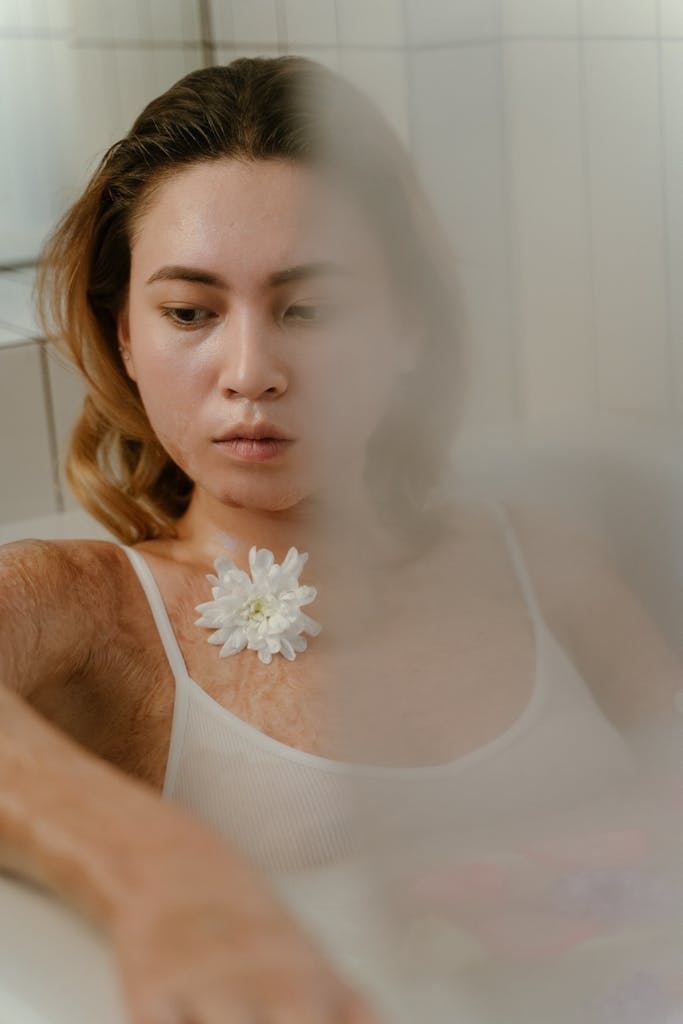 A woman with burn scars embraces beauty with a white flower in a serene setting.